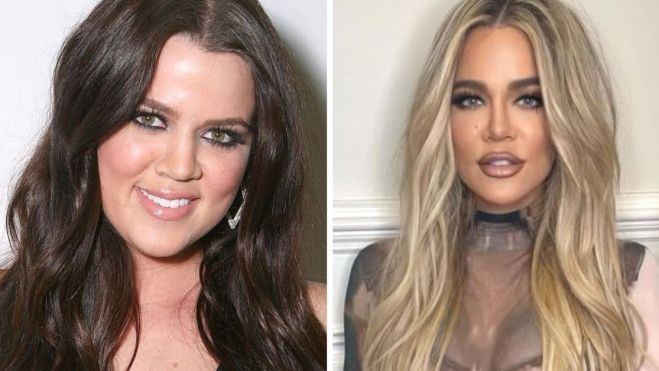 El antes y después de Khloé Kardashian