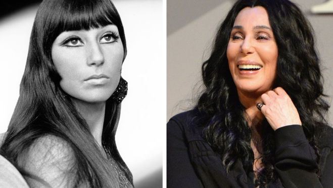 El antes y después de Cher